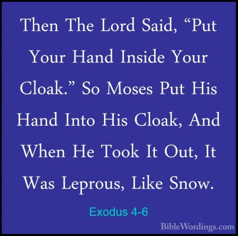 Exodus 4-6 - Then The Lord Said, "Put Your Hand Inside Your CloakThen The Lord Said, "Put Your Hand Inside Your Cloak." So Moses Put His Hand Into His Cloak, And When He Took It Out, It Was Leprous, Like Snow. 