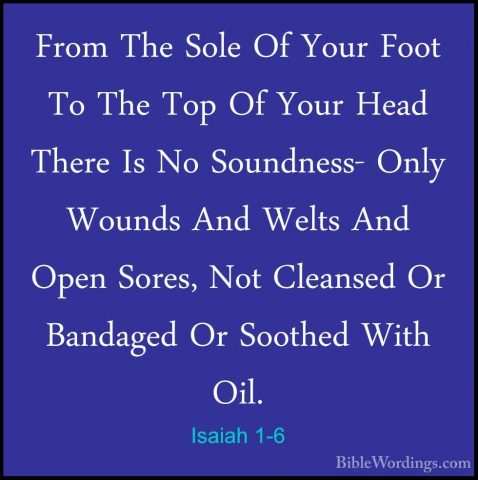 Isaiah 1-6 - From The Sole Of Your Foot To The Top Of Your Head TFrom The Sole Of Your Foot To The Top Of Your Head There Is No Soundness- Only Wounds And Welts And Open Sores, Not Cleansed Or Bandaged Or Soothed With Oil. 