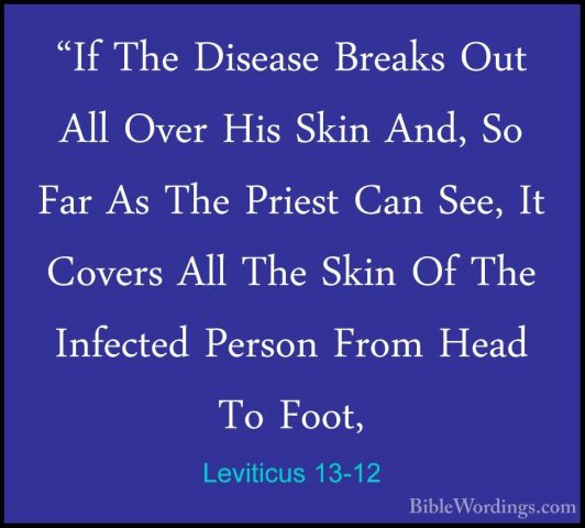 Leviticus 13-12 - "If The Disease Breaks Out All Over His Skin An"If The Disease Breaks Out All Over His Skin And, So Far As The Priest Can See, It Covers All The Skin Of The Infected Person From Head To Foot, 